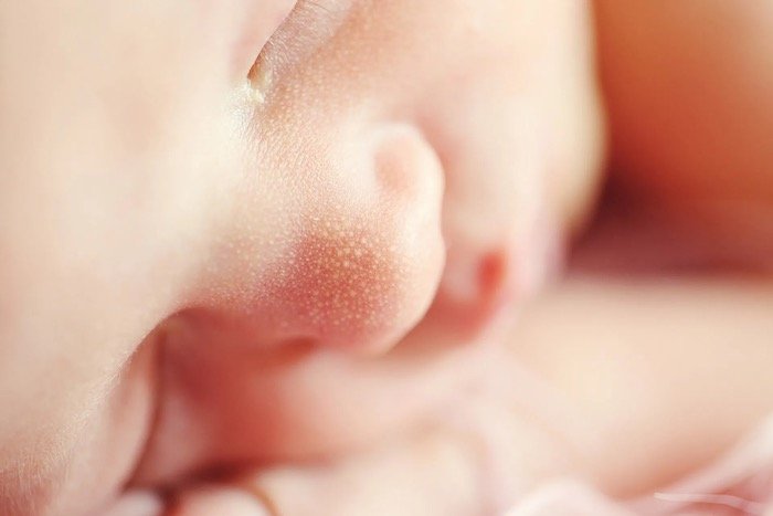 الاطفال - أكزيما الأطفال  أسبابها وطرق علاجها